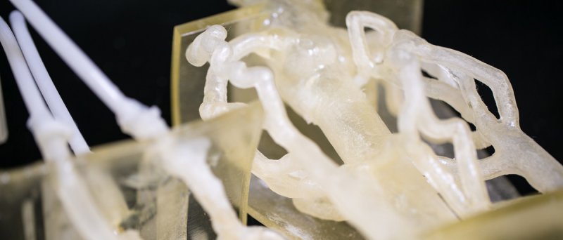 3 D Printed Vascular System Stratasys